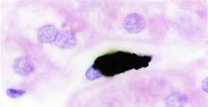 EP T. Montanari, UFRGS Figura 8.32 - Macrófago (célula de Kupffer) que fagocitou partículas de nanquim em um capilar sinusoide.