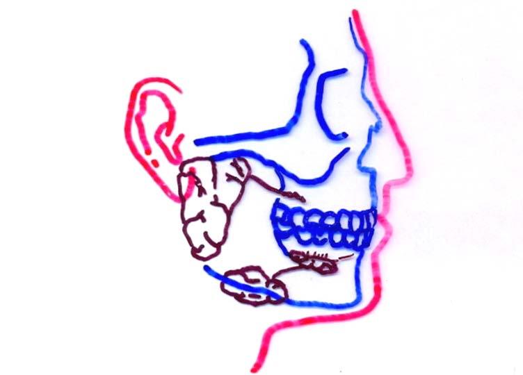 T. Montanari, UFRGS Figura 8.2 - Localização das glândulas salivares maiores. Baseado em Snell, R. S. Histologia clínica. Rio de Janeiro: Discos CBS, Interamericana, 1985. p. 344.