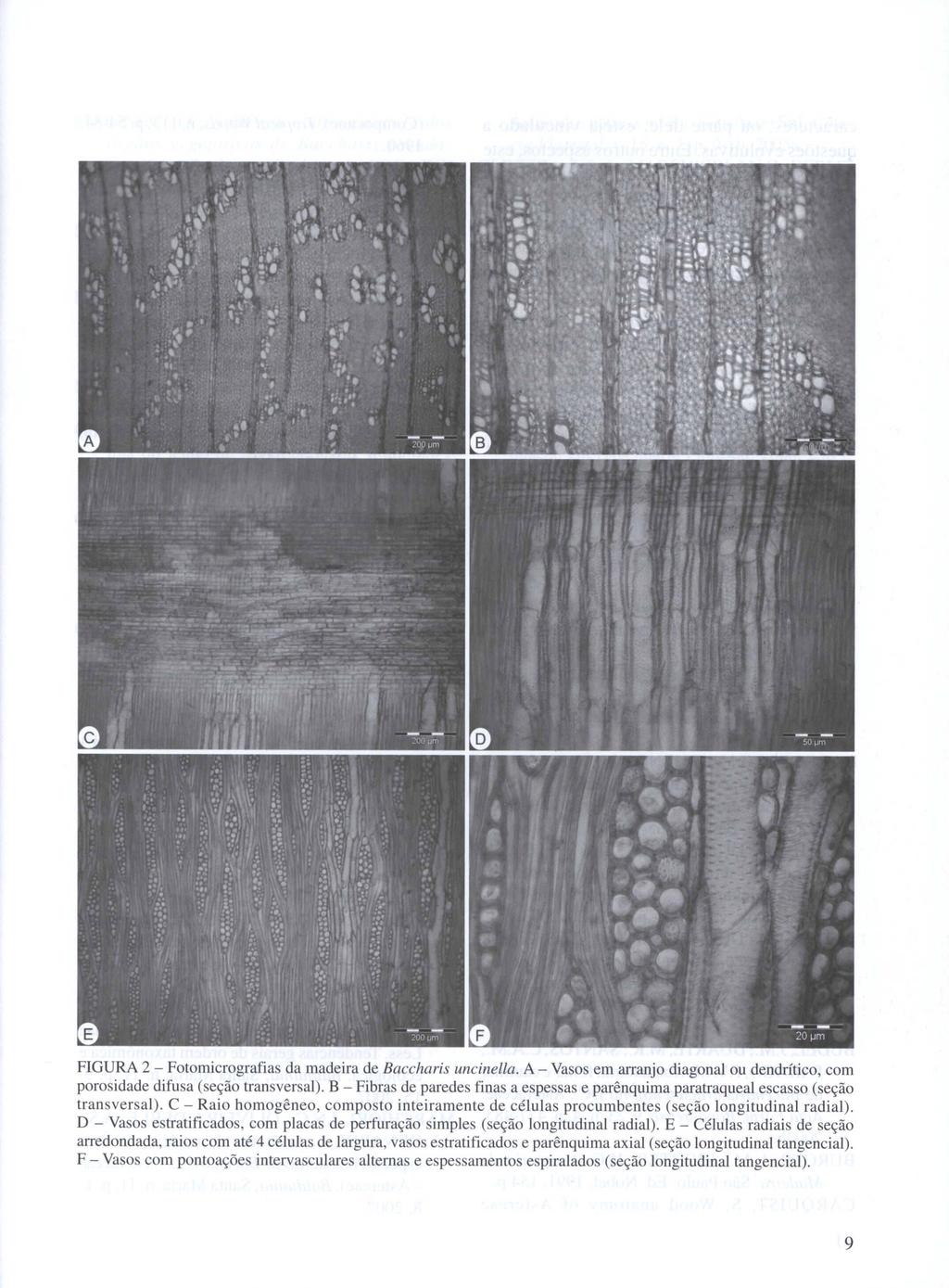FIGURA 2 - Fotomicrografias da madeira de Baccharis uncinella. A - Vasos em arranjo diagonal ou dendrítico, com porosidade difusa (seção transversal).