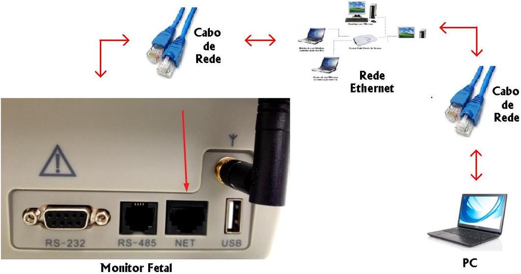 1 Conexão direta do CARDIOTOCÓGRAFO com o COMPUTADOR 1) Utilize um cabo de rede comum; 2) Conecte o cabo na conexão REDE (NET) do CARDIOTOCÓGRAFO e a outra extremidade no computador; 3) Acesse o