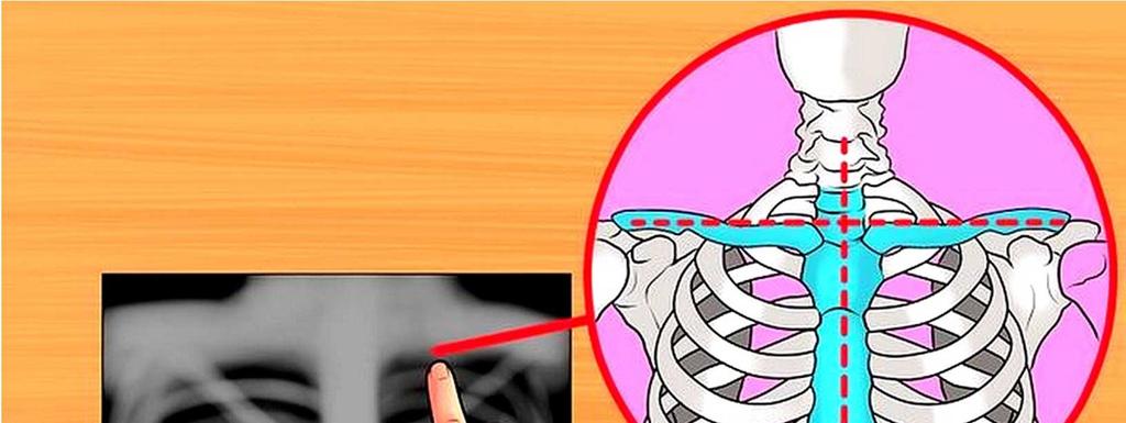 Verifique o alinhamento da coluna torácica com o centro do esterno e entre as clavículas.