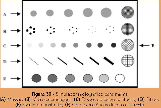 A qualidade da imagem em mamografia deve ser avaliada usando-se um simulador radiográfico de mama (phantom), similar ao adotado pelo Colégio Brasileiro de Radiologia.