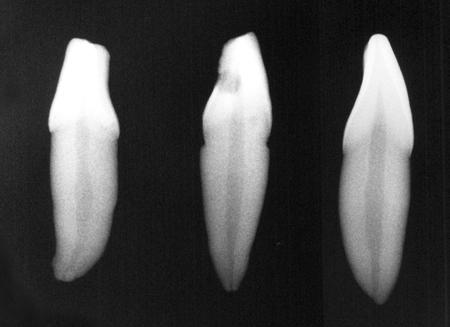 Material e Métodos 60 Foram utilizados neste experimento 36 dentes incisivos inferiores humanos, estocados no Laboratório de Pesquisa de Odontologia da Universidade de Ribeirão Preto e conservados em