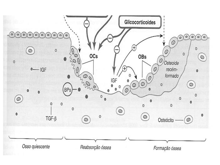 Metabolismo Ósseo RANKL - RANK Osteoclastos Osteoblastos RANKL sintetizado osteoblasto RANK receptor