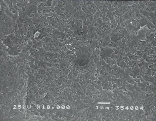 (a) (b) Figura 18: Micrografias eletrônicas