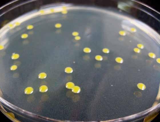 3 Etiologia O agente causal do cancro cítrico é uma bactéria Gram-negativa, aeróbia, baciliforme, com um flagelo polar, facilmente isolada e cultivada em meio de cultura em laboratório.