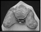 alterações e sua magnitude em relação aos dentes da maxila, utilizando para a avaliação os incisivos (IS), os caninos (CS) e os primeiros molares superiores (1º MS), após o tratamento com a terapia