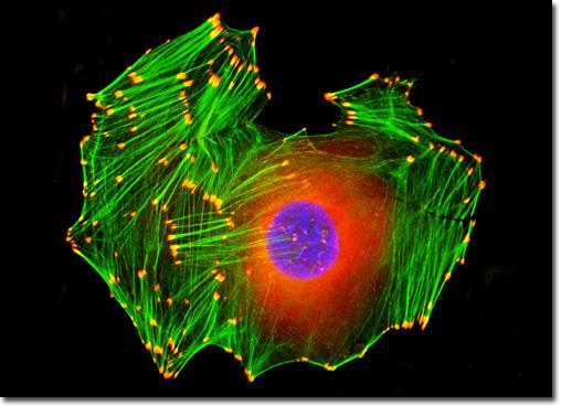 Adesões Focais Vistas ao Microscópio focos alaranjados na extremidade das fibras de estresse (microfilamentos de actina) devido a