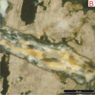 Fotos 23 A e B: Quartzo policristalino do tipo milonítico identificado em subarcóseo moderadamente selecionado totalmente envolvido por cimento carbonático (Foto A: Nicóis paralelos e Foto B: Nicóis