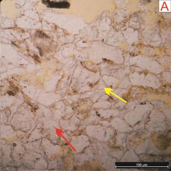 dissolução parcial, gerando porosidade (setas pretas), observados em subarcóseo