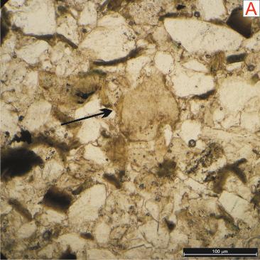 72 Fotos 49 A e B: Quartzarenito pobremente selecionado mostrando o grão de feldspato em processo de caulinização na fase telodiagenética (Foto A: Nicóis