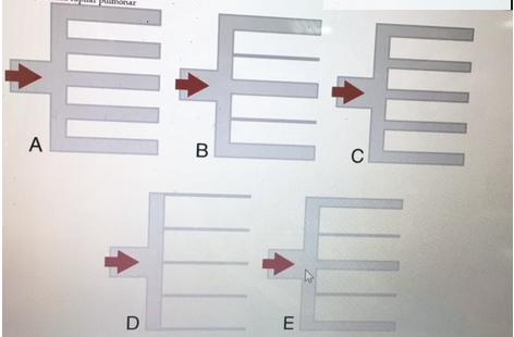 respiratória de 15 respirações /min. Qual é o volume residual (VR)? a. 500 ml b. 1000mL c. 1500mL d. 2500mL e.