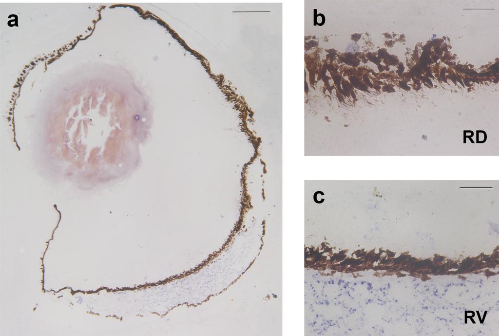 Expressão do gene opn4b nos olhos de Anableps anableps Hibridização in situ para o gene opn4b não detectou expressão deste gene durante o estágio larval estudado, porém, análise de transcriptoma das