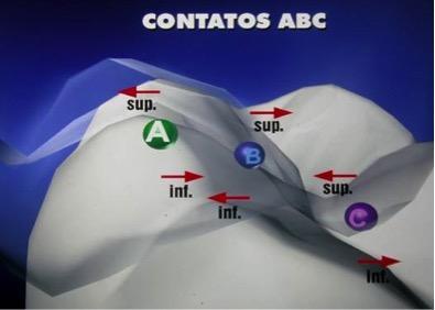 22 FIGURA 8 - Vetores horizontais remanescentes que levariam à movimentação. (Imagens cedidas por Dr.