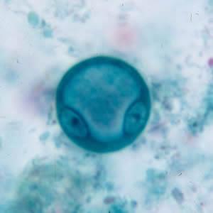 Figura 5 Quistos de Entamoeba coli corados com iodo