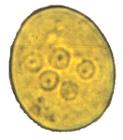 Amibas Entamoeba histolytica/dispar Entamoeba hartmanni Entamoeba coli Entamoeba polecki Endolimax nana Pseudolimax butschlii 10 µm