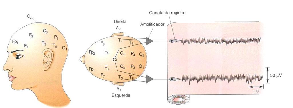 Ciclo sono-vigília O Eletroencefalograma (EEG)