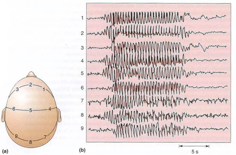 Ritmos do EEG e epilepsia Neurociências-Desvendando o