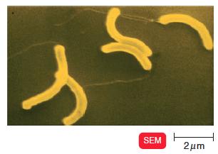 FORMA BACTERIANA Espiral