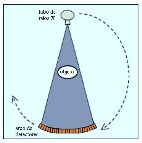 Os feixes de raios X emitidos possuem uma abertura muito ampla, localizada do lado oposto à fonte de raios X, uma linha de 200 a 1000 detectores dispostos em ângulo recebe a radiação após passar pelo