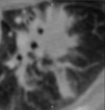 O ITK foi desenvolvido com financiamento da National Library of Medicine como um recurso aberto de algoritmos para analisar as imagens do Visible Human Project.