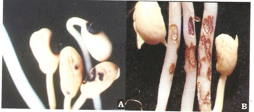 Sintomas de Colletotrichum lindemuthianum (A) e Rhizoctonia solani