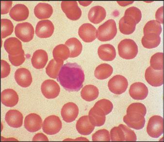 Imunobiologia 23 Células dendríticas Macrófagos
