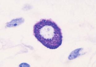 Imunobiologia 5 Célula Macrófago Célula dendrítica Neutrófilo Função quando ativadas Fagocitose e ativação de mecanismos bactericidas Apresentação de