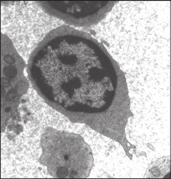 Observe a cromatina condensada do núcleo, indicando pouca atividade transcricional, a ausência relativa de citoplasma e o tamanho pequeno.