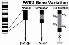 dilatação do arco aórtico) A SXF é causada por mutação no gene FMR1, localizado no cromossomo X, que leva à deficiência da proteína FMRP (Fragile X Mental Retardation Protein).