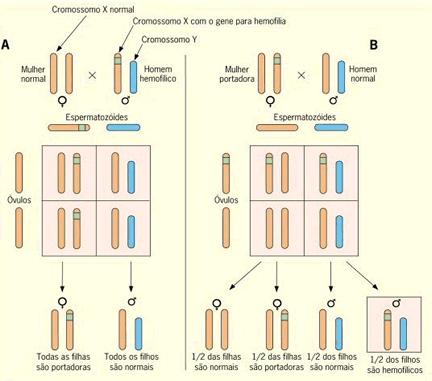 HEMOFILIA É um distúrbio da coagulação sangüínea, em que falta o fator VIII, uma das proteínas envolvidas no processo, encontrado no plasma das pessoas normais.