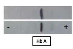 Resultados A separação das Hbs por eletroforese de acetato de celulose (Figura 35) e IEF (Figura 36) revelou apenas a presença de Hb A.