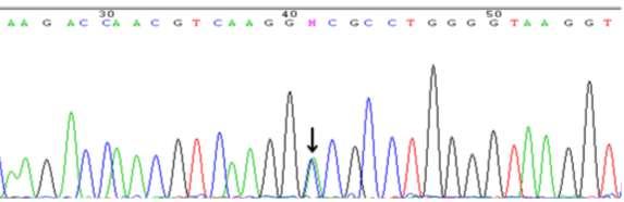 Caraterização molecular e funcional de variantes alfa de hemoglobina identificadas no Centro Hospitalar e Universitário de Coimbra ácido aspártico em vez de uma alanina (Ala Asp).