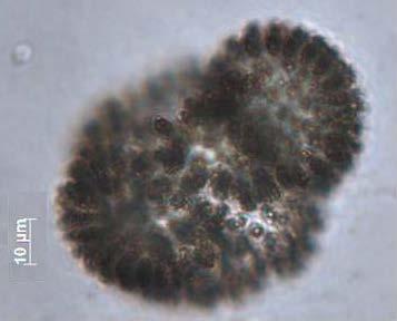 ampla; células ovóides, com aerótopos, 3,5-4 µm diâmetro,