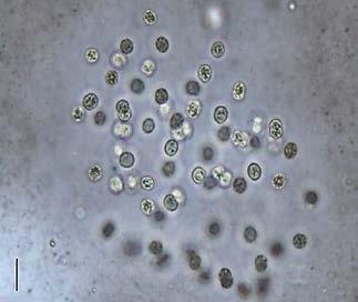 células na mucilagem; mucilagem hialina, difluente, ampla e com borda