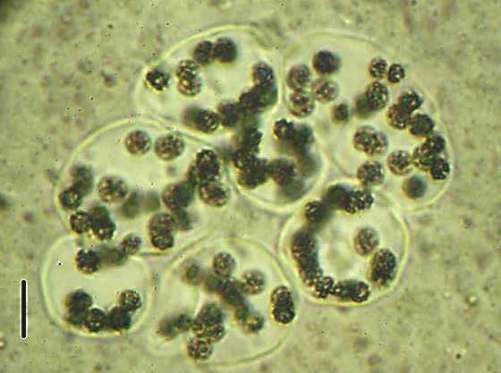 Divisão Cyanobacteria Ordem Chroococcales Família Microcystaceae Microcystis wesenbergii Komárek Colônias esféricas, alongadas, irregulares, lobadas,