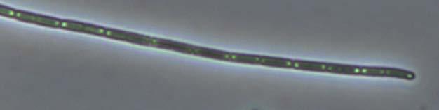 isodiamétricas; 1-3 µm diâmetro, 2-7 µm comprimento; célula apical cilíndrica com ápice arredondado.