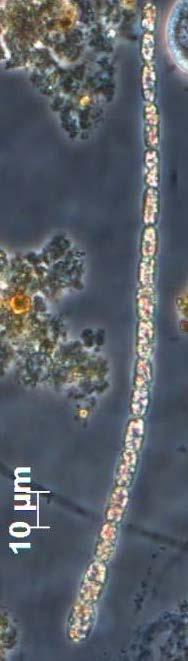 Divisão Cyanobacteria Ordem Nostocales Família Nostocaceae