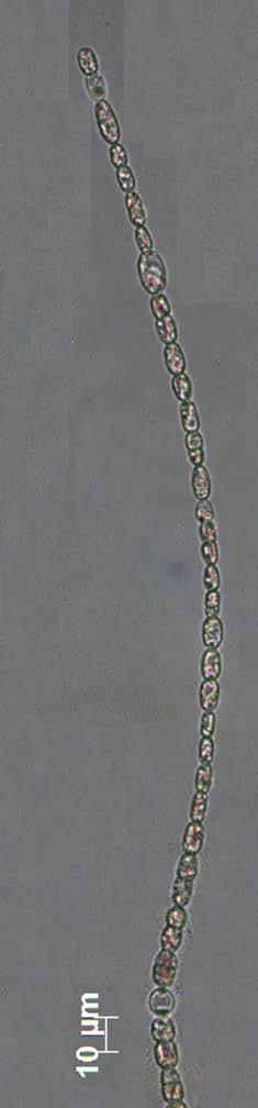 7,5-9,8 μm comprimento, com aerótopos; célula apical