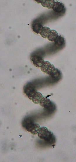 Divisão Cyanobacteria Ordem Nostocales Família Nostocaceae Dolichospermum crassum (Lemmermann)