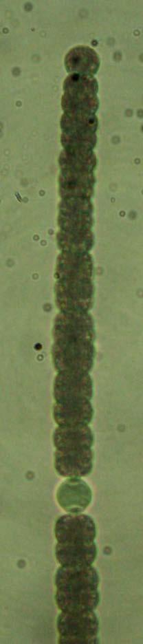 Divisão Cyanobacteria Ordem Nostocales Família Nostocaceae Dolichospermum
