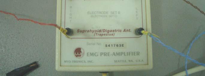 Material e Método 36 Figura 4.4: Amplificador do eletromiógrafo com os fios condutores conectados.