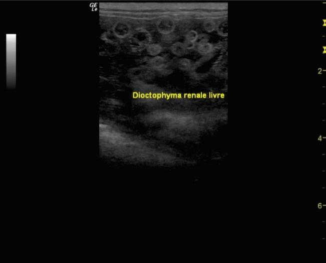 Eliminação de Dioctophyme renale Além das alterações citadas, constatou-se que os rins apresentavam formato anatômico alterado: no rim esquerdo, observou-se um aumento de volume e presença de D.