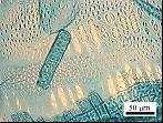 POSTERS TEMA 4 567 respectivamente. O diâmetro médio dos vasos foi de 205 µm, aumentando radialmente da medula para a periferia de 185 µm a 223 µm, respectivamente (Figura 6).