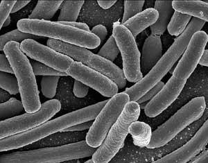 a) b) c) d) A bactéria Escherichia coli é uma das integrantes mais comuns da nossa flora intestinal.