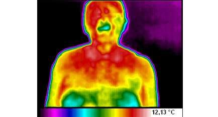 Termografia: Curiosidade visão humana através do espectro infravermelho Detecta áreas inflamadas através da