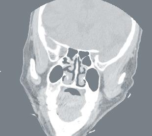 CT325 fornece