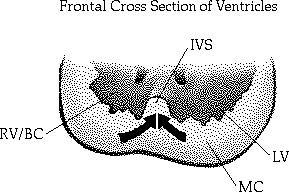 SEPTO INTERVENTRICULAR MUSCULAR surge da parede caudal entre os ventrículos e cresce em direção aos coxins