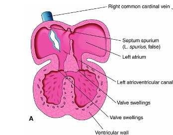 interventricular