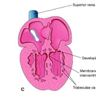 A divisão completa dos vetrículos occore com o SEPTO AORTICOPULMONAR, que é contínuo com a porção membranar do Septo Intreaventricular membranar